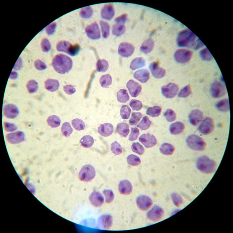 трихомонады в микроскопии отделяемого уретры