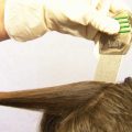 Вши в волосах: методы определения и способы лечения
