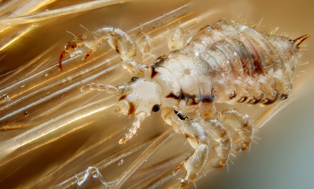 Белые вши на голове. Головная вошь - Pediculus capitis.