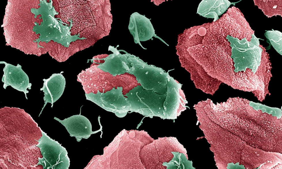 Chlamydia trichomonas. Trichomonas vaginalis под микроскопом. Трихомонада микроскопия. Возбудитель урогенитального трихомониаза. Трихомоноз воздействие на организм.