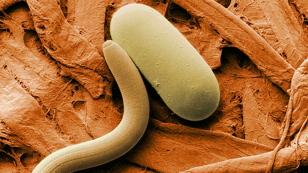 Гельминты у взрослых: симптомы и лечение глистов в организме, кишечнике