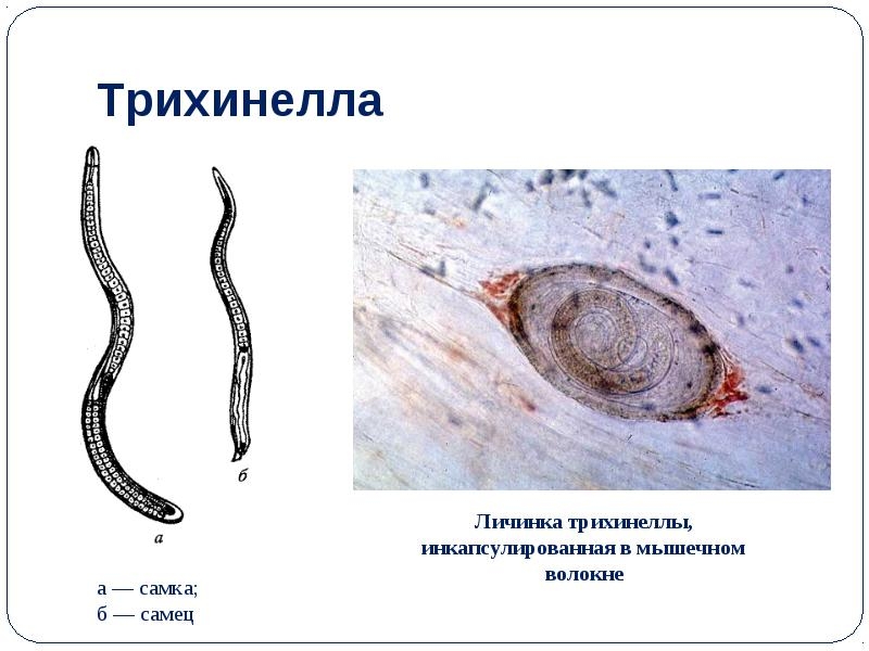 Рисунок трихинеллы в мышцах с обозначениями личинка