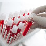 Как правильно сдавать анализ крови на глисты
