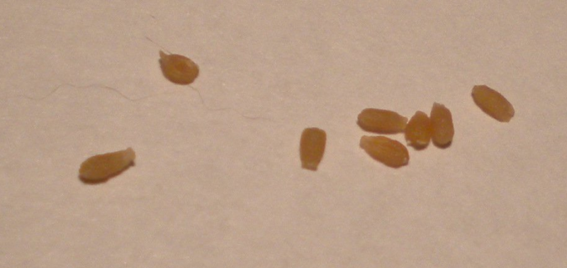 Яйца глистов под микроскопом фото