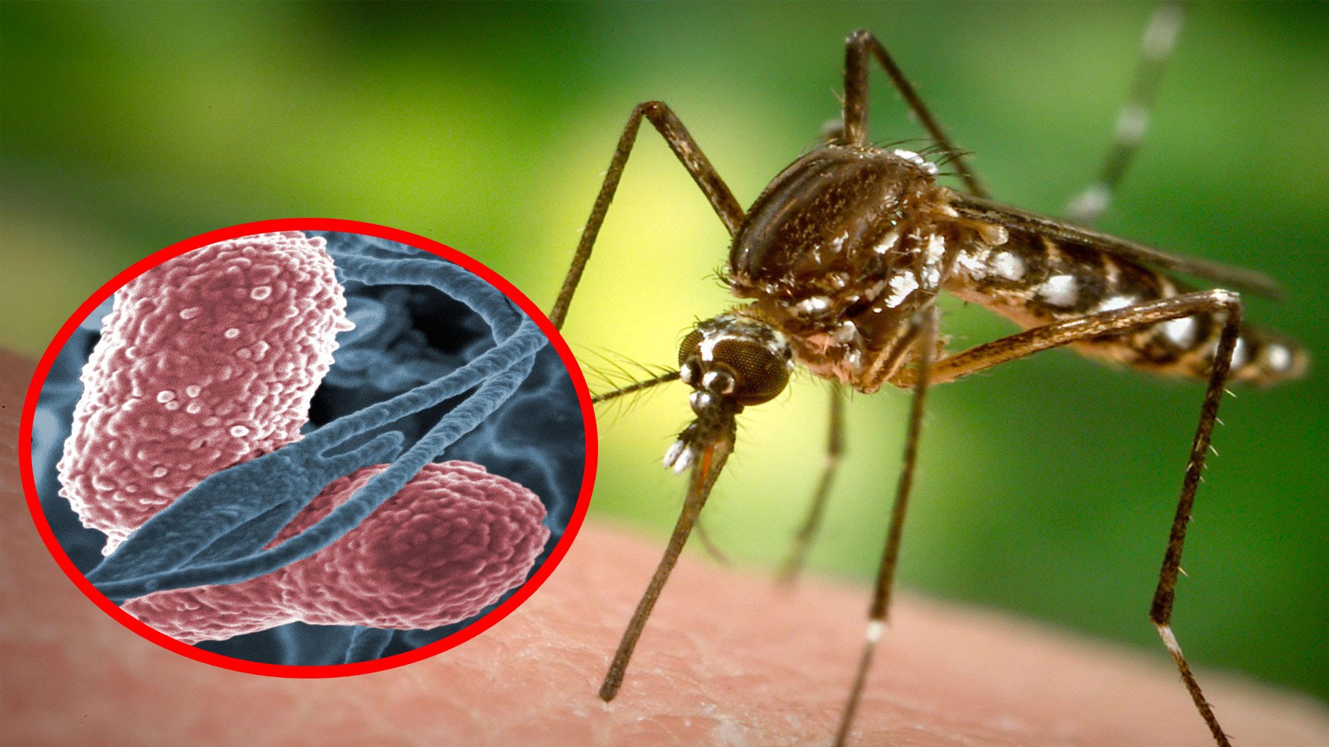 История малярии. Малярийный комар и Пискун. Укус Малери малярийный комар. Малярийный комар под микроскопом.