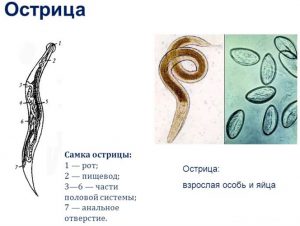 Схема лечения остриц