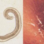 Что такое острица, яйца и личинки паразита