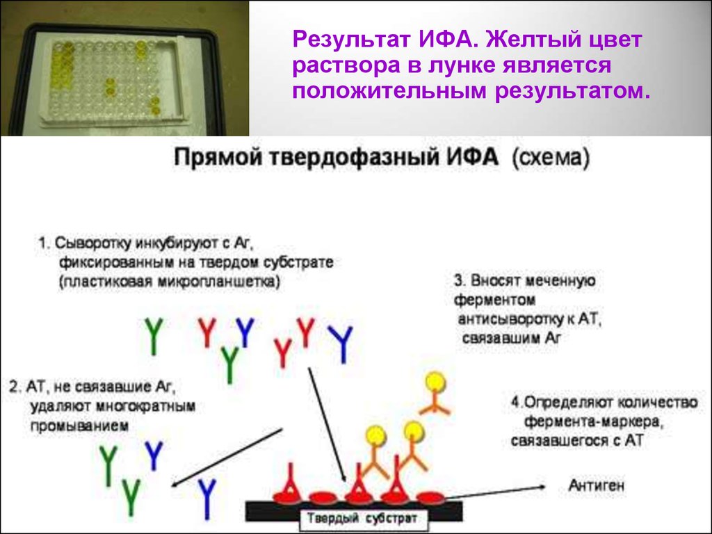 Схема ифа микробиология