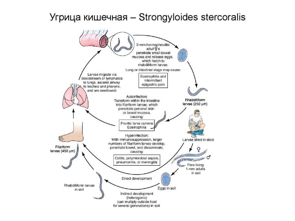 Схема жизненный цикл угрицы кишечной