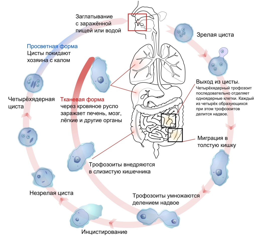 Патогенез дизентерии схема