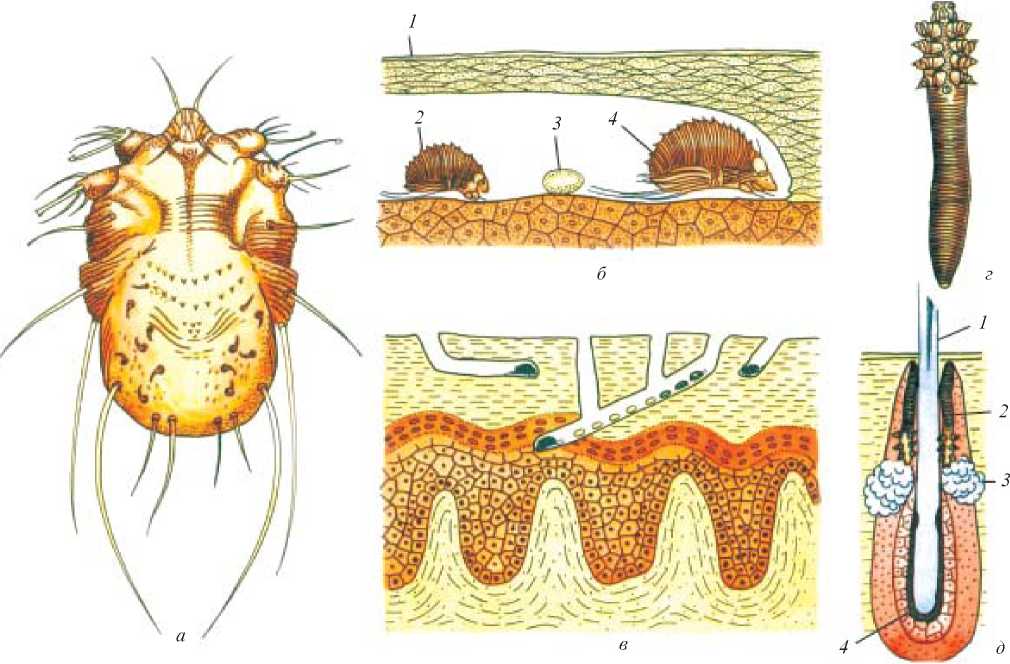 Чесоточными клещами. Клещ чесоточный зудень. Личинка чесоточного клеща. Чесоточный клещ строение.