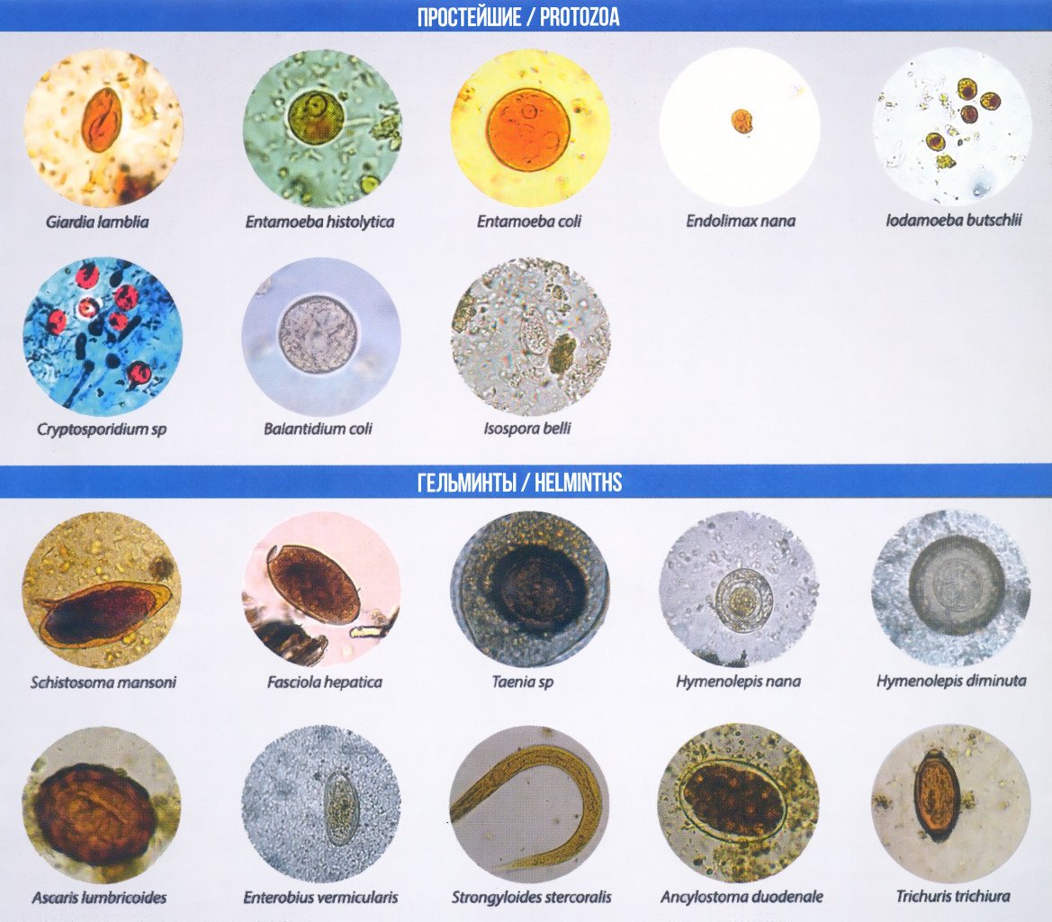 Яйца гельминтов микроскопия