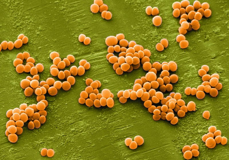 бактерии золотистого стафилококка
