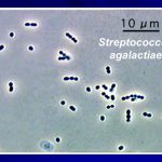streptococcus agalactiae