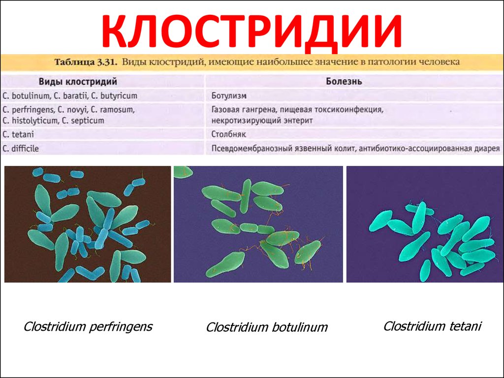 Клостридии в сыре фото