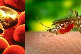 Что такое малярия: симптомы, диагностика и лечение