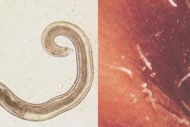 Что такое острица, яйца и личинки паразита