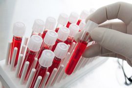 Как правильно сдавать анализ крови на глисты