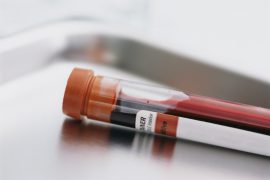 Какие существуют анализы по крови на обнаружение паразитов