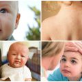 Причины и симптомы аскарид у ребенка, лечение и профилактика