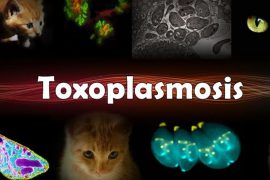 Токсоплазмоз. Способы заражения и профилактика заболевания