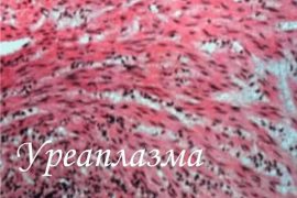 Ureaplasma spp (уреаплазма спп)