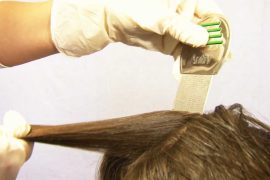 Вши в волосах: методы определения и способы лечения