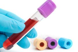 Как сдавать анализ крови для диагностики