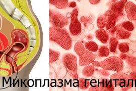 Микоплазма гениталиум
